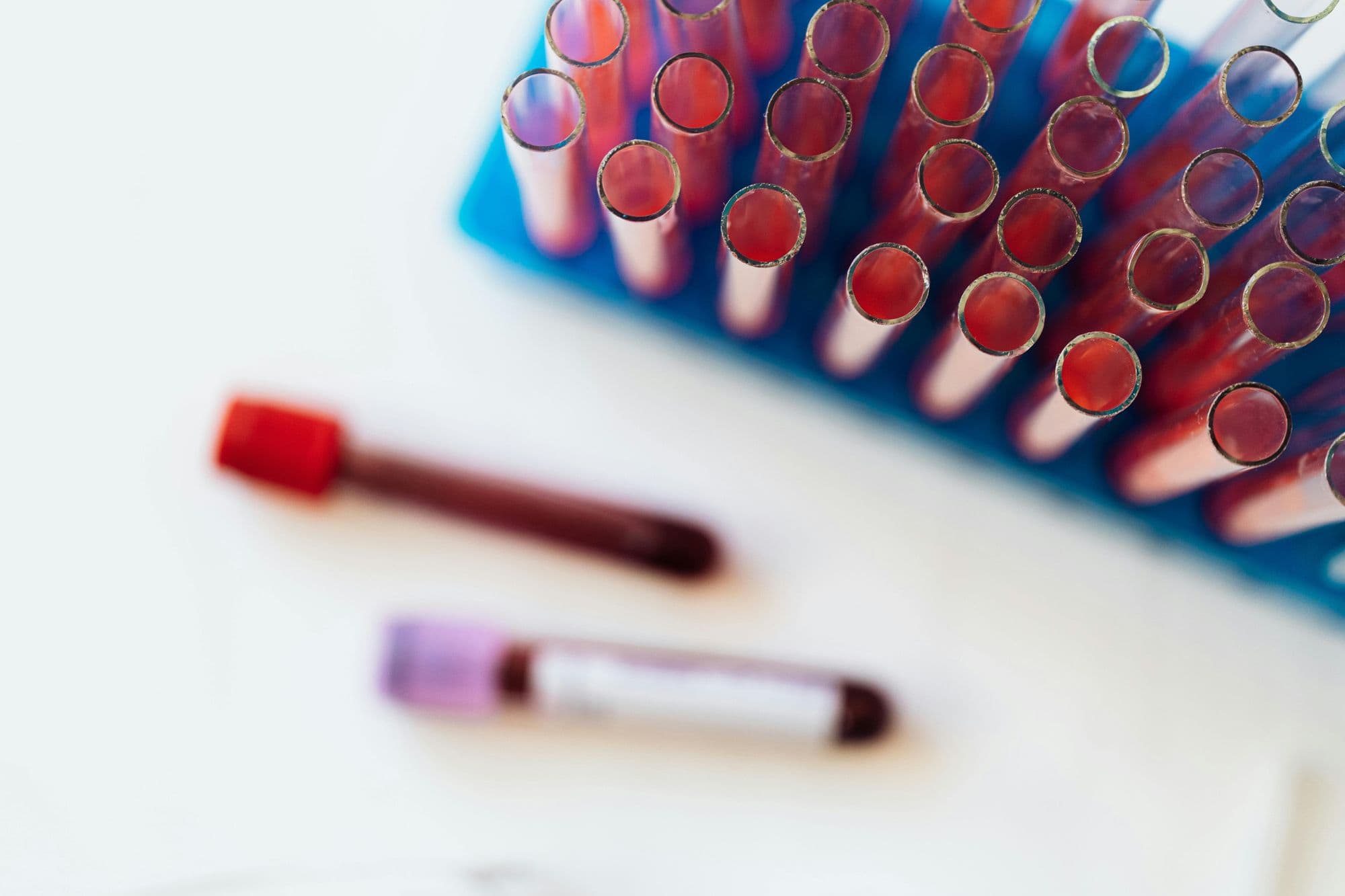 Clinical sample processing in a laboratory
